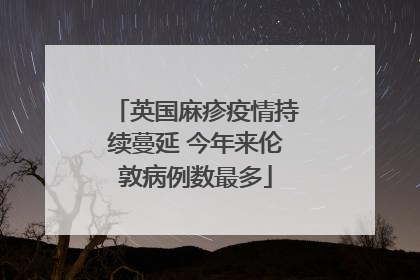 英国麻疹疫情持续蔓延 今年来伦敦病例数最多